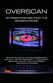 Overscan by Nicholas Bernhard